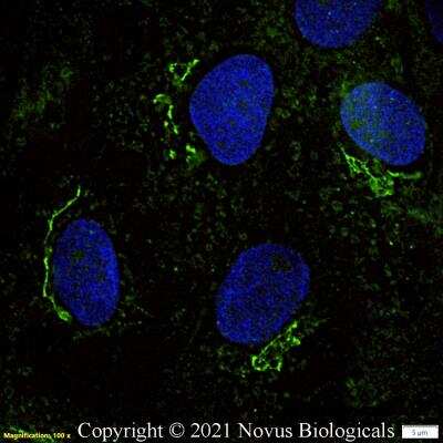 Immunocytochemistry/Immunofluorescence: GM130/GOLGA2 Antibody [FITC] [NBP2-53420F] - A431 cells were fixed in 4% paraformaldehyde for 10 minutes and permeabilized in 0.05% Triton X-100 in PBS for 5 minutes. The cells were incubated with GM130/GOLGA2 Antibody conjugated to FITC (NBP2-53420F) at 2 ug/ml for 1 hour at room temperature. Nuclei were counterstained with DAPI (Blue). Cells were imaged using a 100X objective and digitally deconvolved.